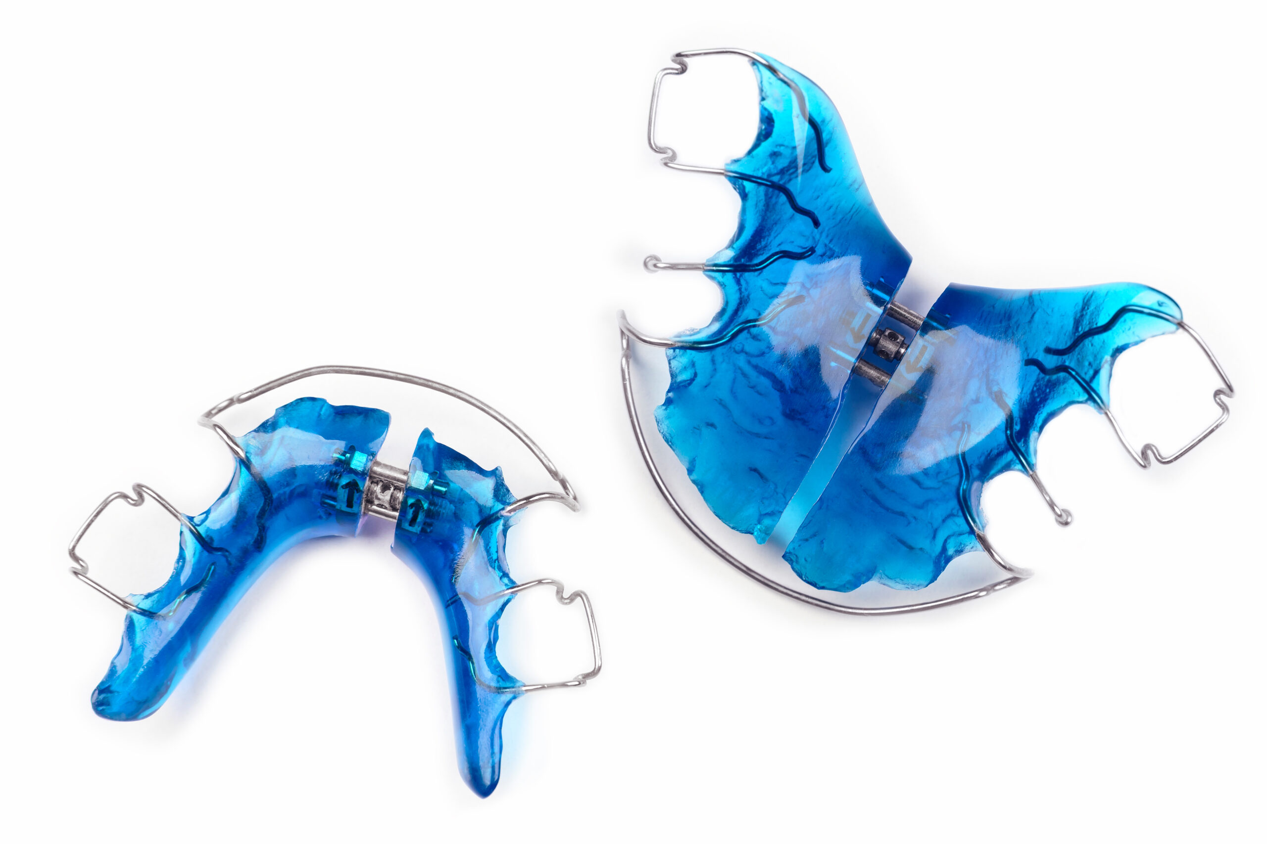 herausnehmbare Zahnspange